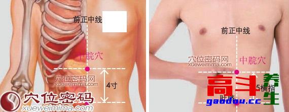 体质不同，施灸有别——痰湿体质艾灸方法