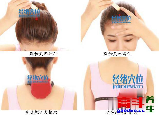艾灸（按摩、刮痧）治疗更年期眩晕的